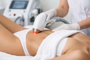 Lézeres szőrtelenítés intim terület: mire számítson?